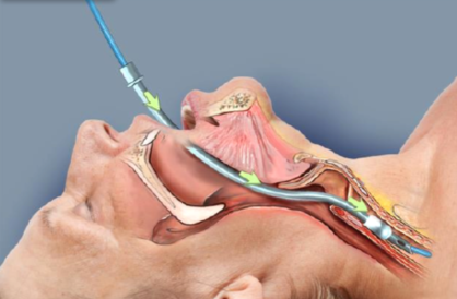 interactive tutorial of an intubation procedure for use in a trial 